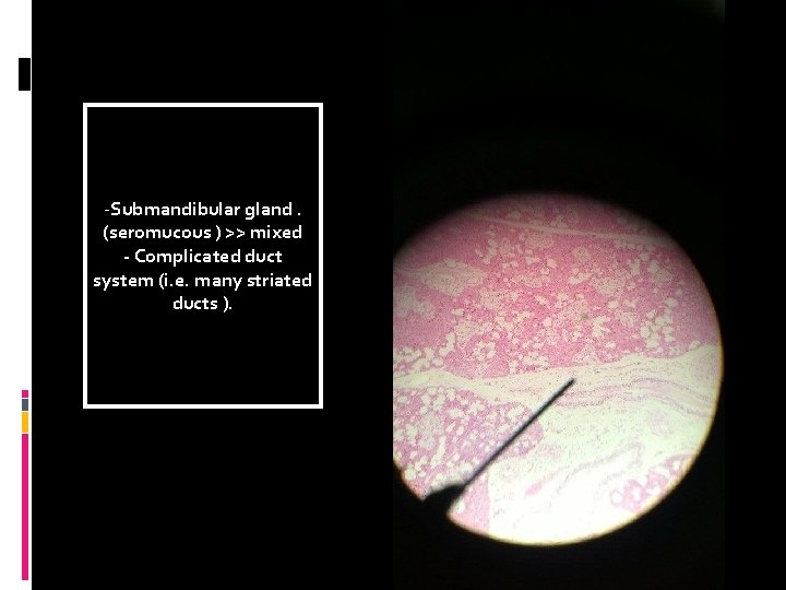 -Submandibular gland. (seromucous ) >> mixed - Complicated duct system (i. e. many striated