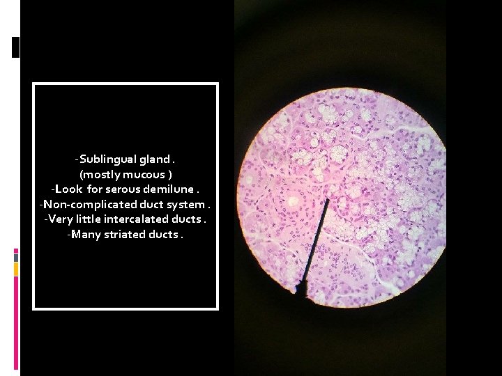 -Sublingual gland. (mostly mucous ) -Look for serous demilune. -Non-complicated duct system. -Very little