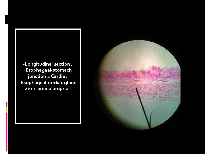 -Longitudinal section. -Esophageal-stomach junction = Cardia. -Esophageal cardiac gland >> in lamina propria. 
