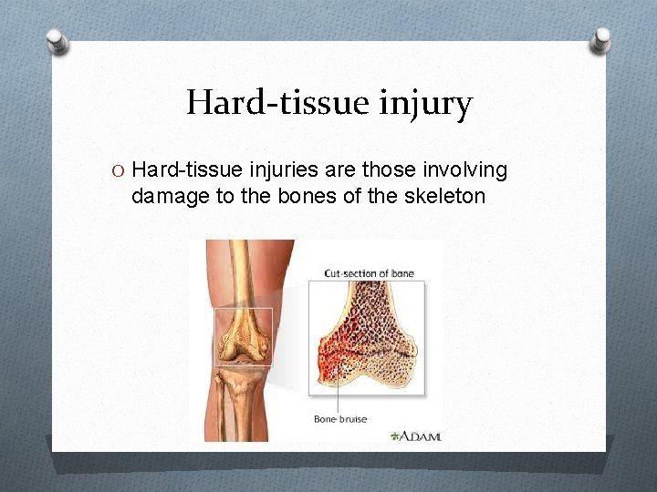 Hard-tissue injury O Hard-tissue injuries are those involving damage to the bones of the