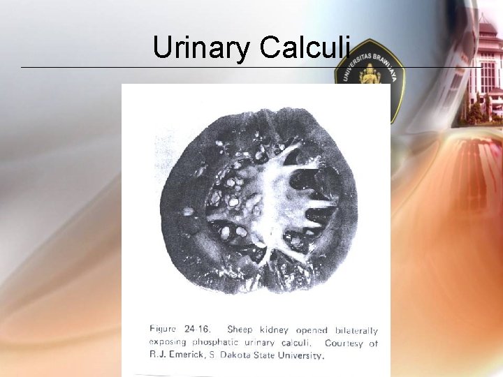 Urinary Calculi 