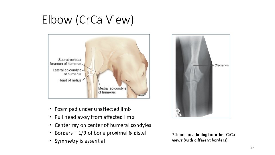 Elbow (Cr. Ca View) • • • Foam pad under unaffected limb Pull head