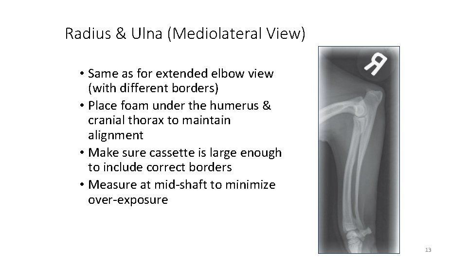 Radius & Ulna (Mediolateral View) • Same as for extended elbow view (with different