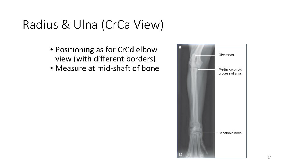 Radius & Ulna (Cr. Ca View) • Positioning as for Cr. Cd elbow view