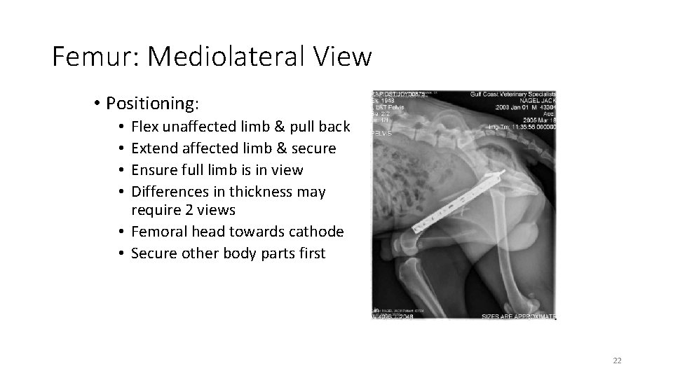 Femur: Mediolateral View • Positioning: Flex unaffected limb & pull back Extend affected limb