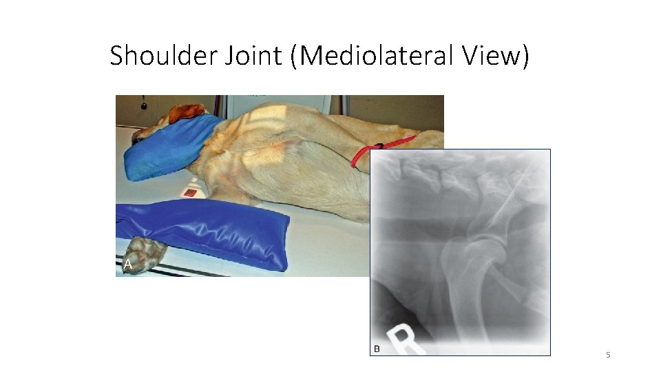 Shoulder Joint (Mediolateral View) 5 