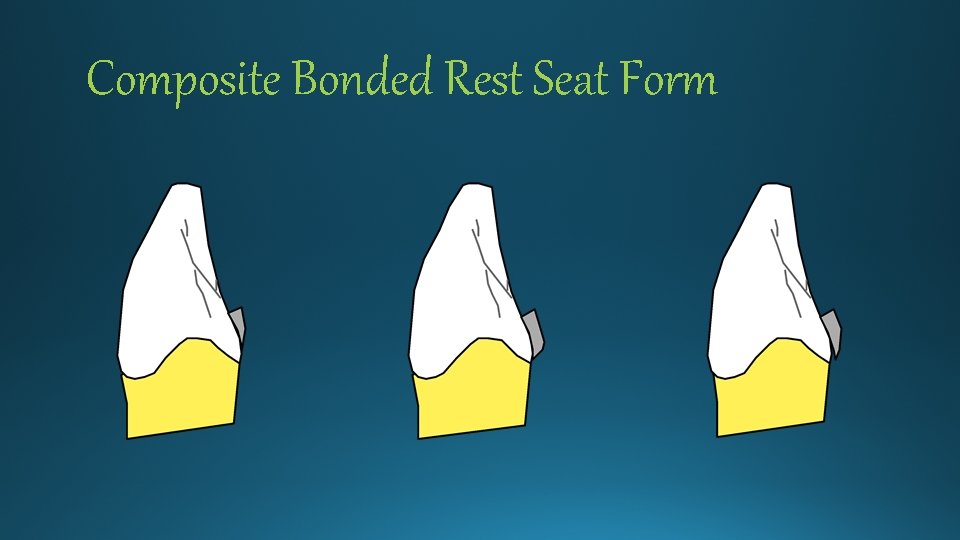Composite Bonded Rest Seat Form 