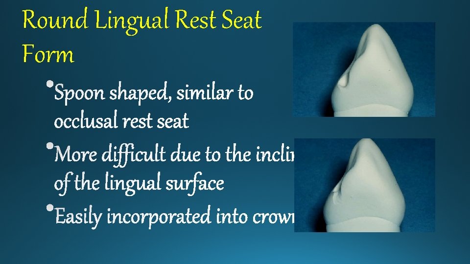 Round Lingual Rest Seat Form 