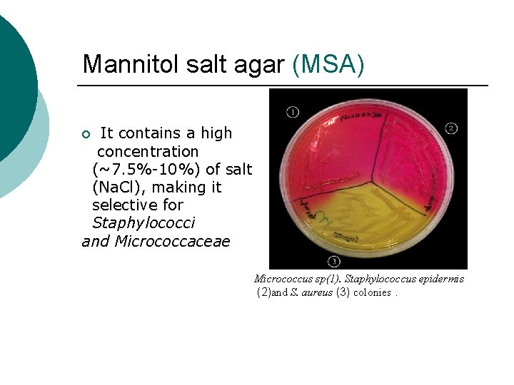 Mannitol salt agar (MSA) It contains a high concentration (~7. 5%-10%) of salt (Na.
