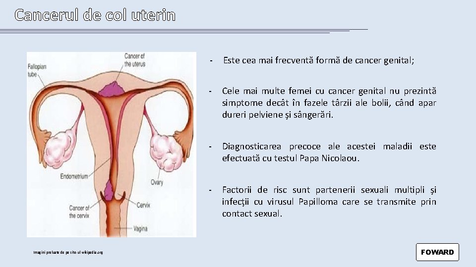 Cancerul de col uterin Imagini preluate de pe site-ul wikipedia. org - Este cea