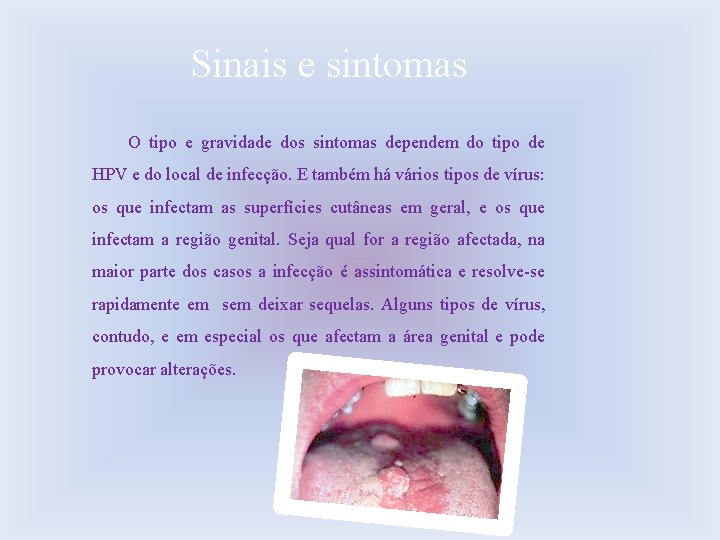 Sinais e sintomas O tipo e gravidade dos sintomas dependem do tipo de HPV