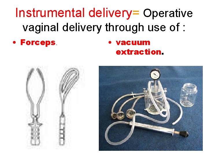Instrumental delivery= Operative vaginal delivery through use of : • Forceps. • vacuum extraction.