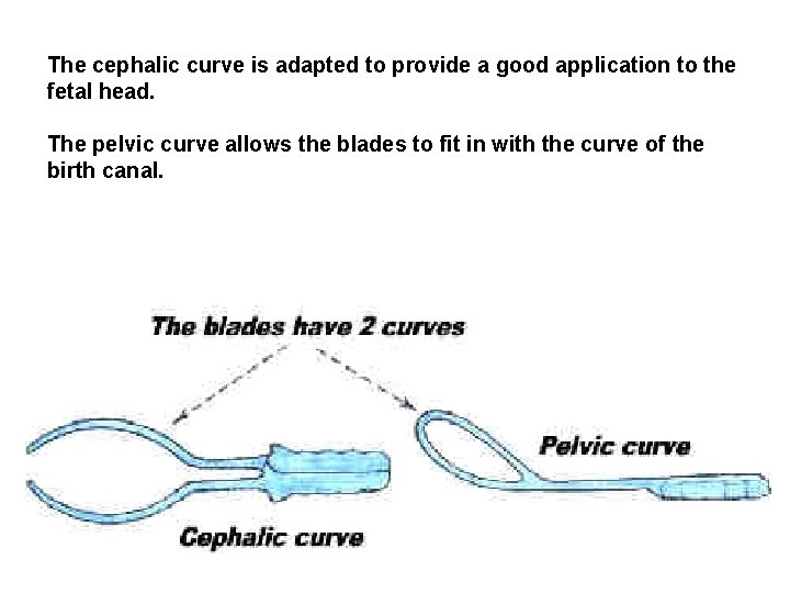 The cephalic curve is adapted to provide a good application to the fetal head.