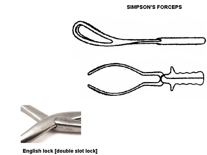 SIMPSON’S FORCEPS English lock [double slot lock] 