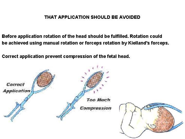 THAT APPLICATION SHOULD BE AVOIDED Before application rotation of the head should be fulfilled.
