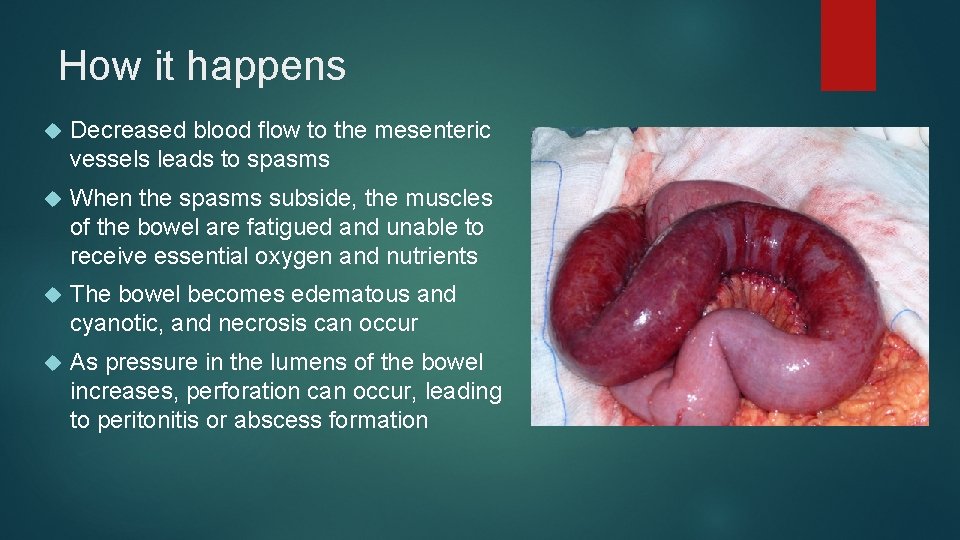 How it happens Decreased blood flow to the mesenteric vessels leads to spasms When
