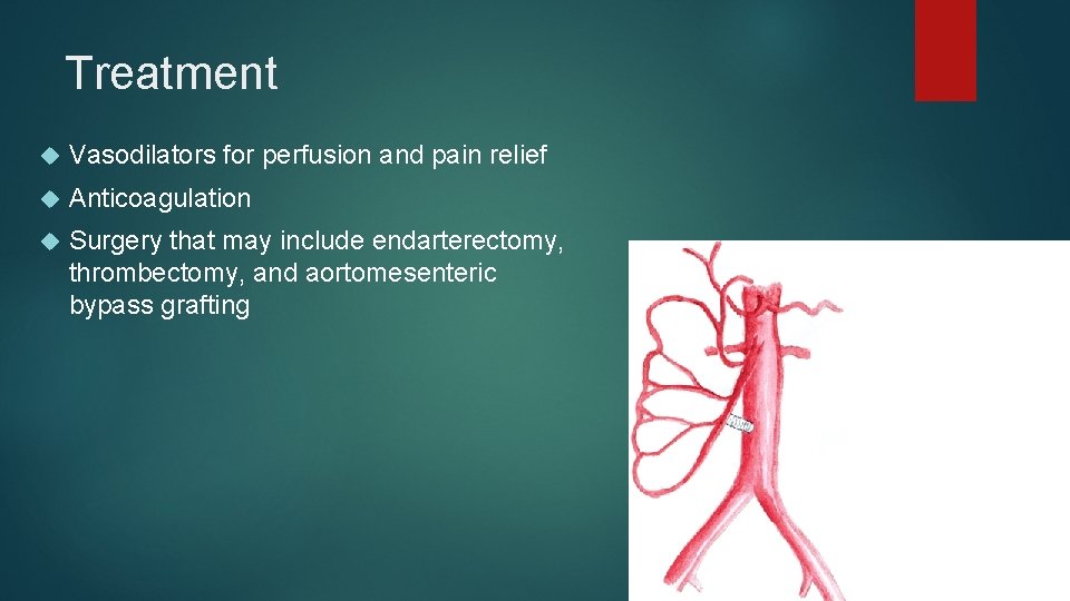 Treatment Vasodilators for perfusion and pain relief Anticoagulation Surgery that may include endarterectomy, thrombectomy,