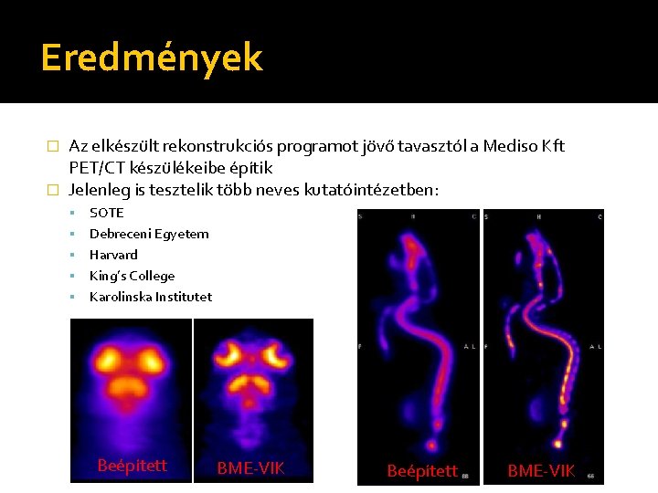 Eredmények Az elkészült rekonstrukciós programot jövő tavasztól a Mediso Kft PET/CT készülékeibe építik �