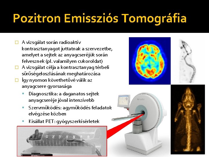 Pozitron Emissziós Tomográfia A vizsgálat során radioaktív kontrasztanyagot juttatnak a szervezetbe, amelyet a sejtek