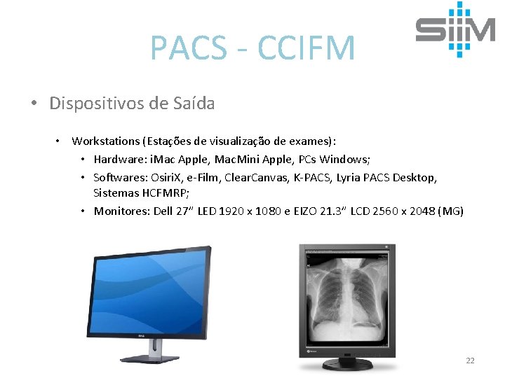 PACS - CCIFM • Dispositivos de Saída • Workstations (Estações de visualização de exames):