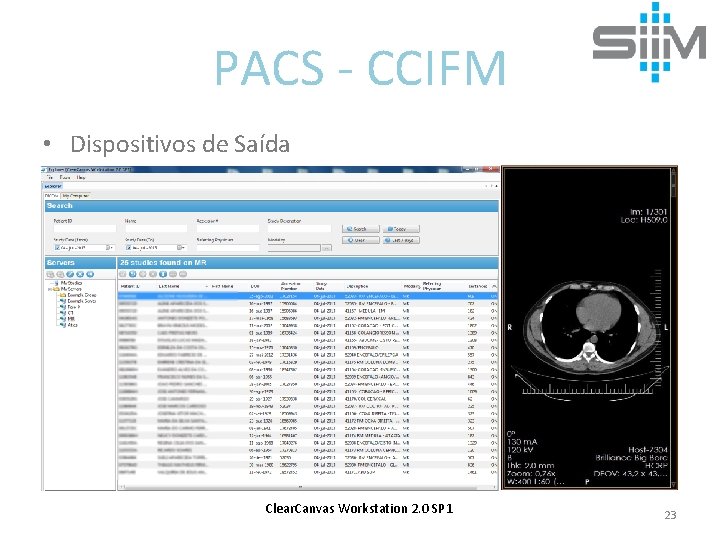 PACS - CCIFM • Dispositivos de Saída Clear. Canvas Workstation 2. 0 SP 1