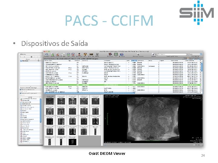 PACS - CCIFM • Dispositivos de Saída Osiri. X DICOM Viewer 24 