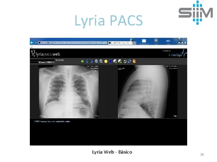 Lyria PACS Lyria Web - Básico 26 