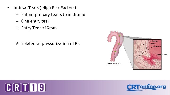  • Intimal Tears ( High Risk Factors) – Patent primary tear site in