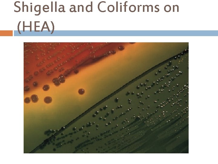 Shigella and Coliforms on (HEA) 