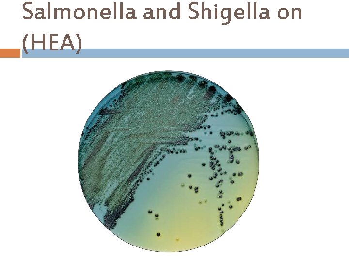 Salmonella and Shigella on (HEA) 