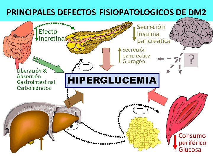 PRINCIPALES DEFECTOS FISIOPATOLOGICOS DE DM 2 Secreción Insulina pancreática Efecto Incretina - ? HIPERGLUCEMIA