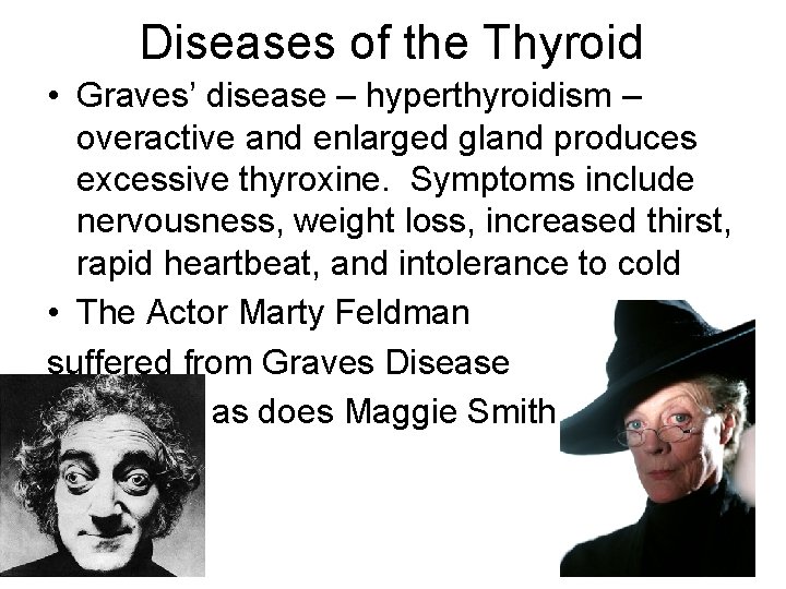 Diseases of the Thyroid • Graves’ disease – hyperthyroidism – overactive and enlarged gland