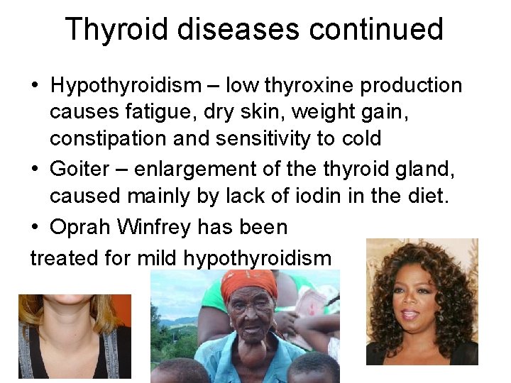Thyroid diseases continued • Hypothyroidism – low thyroxine production causes fatigue, dry skin, weight