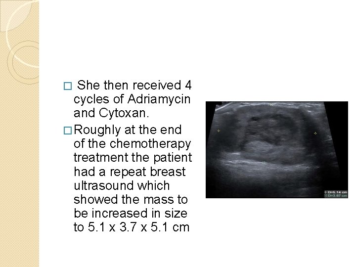 She then received 4 cycles of Adriamycin and Cytoxan. � Roughly at the end