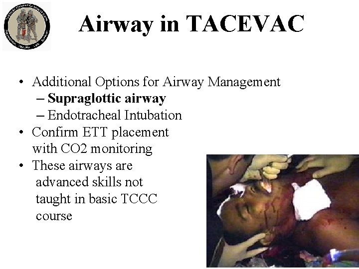 Airway in TACEVAC • Additional Options for Airway Management – Supraglottic airway – Endotracheal