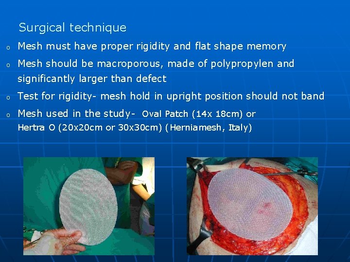 Surgical technique o Mesh must have proper rigidity and flat shape memory o Mesh