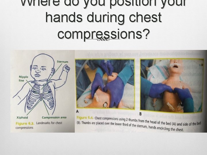 Where do you position your hands during chest compressions? Where do you position your hands during chest compressions?