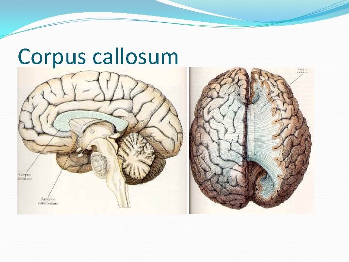 Corpus callosum 