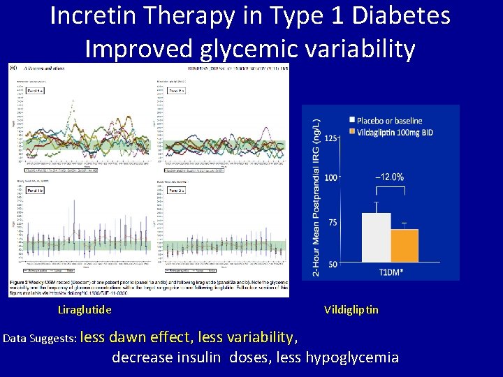 Incretin Therapy in Type 1 Diabetes Improved glycemic variability Liraglutide Data Suggests: less Vildigliptin
