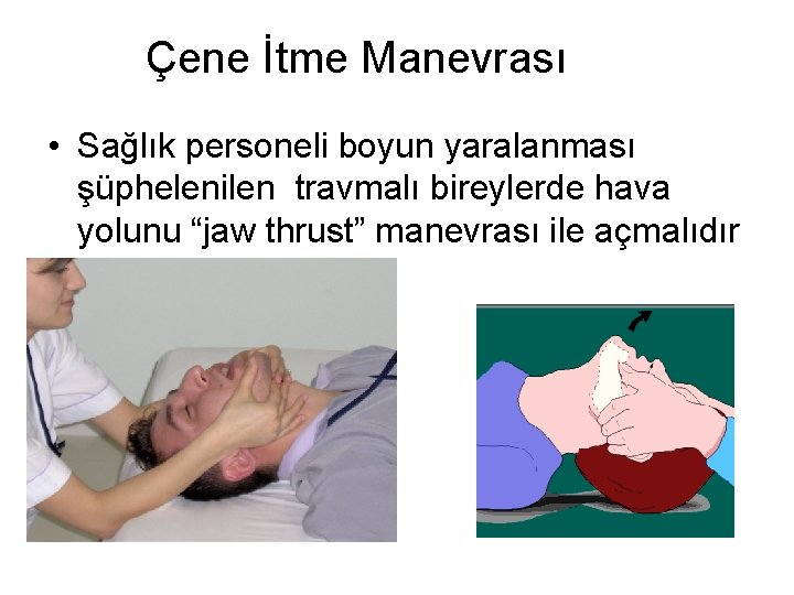 Çene İtme Manevrası • Sağlık personeli boyun yaralanması şüphelenilen travmalı bireylerde hava yolunu “jaw