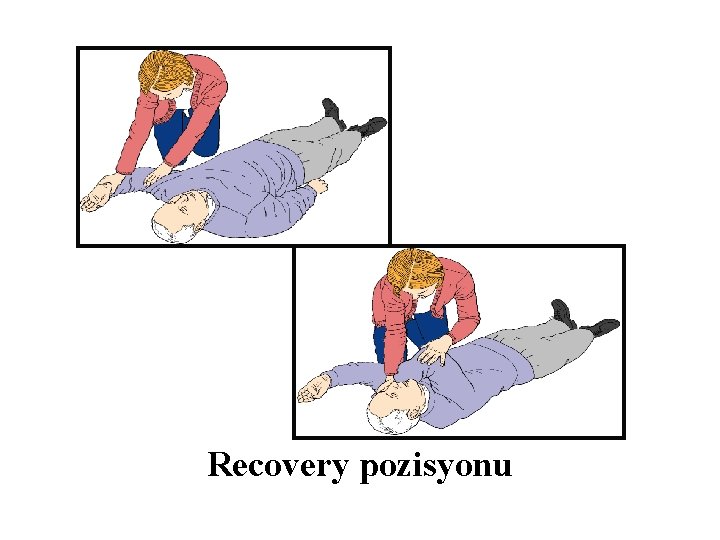 Recovery pozisyonu 