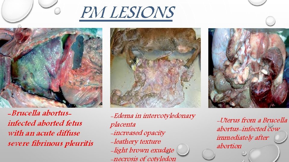 PM LESIONS -Brucella abortusinfected aborted fetus with an acute diffuse severe fibrinous pleuritis -Edema