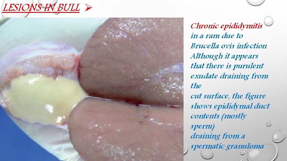 LESIONS IN BULL Ø Chronic epididymitis in a ram due to Brucella ovis infection