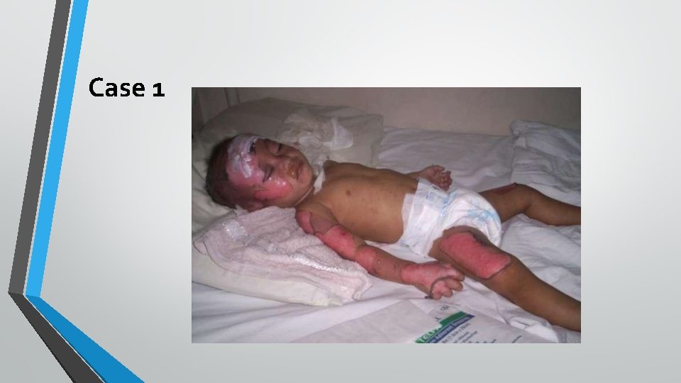 Case 1 