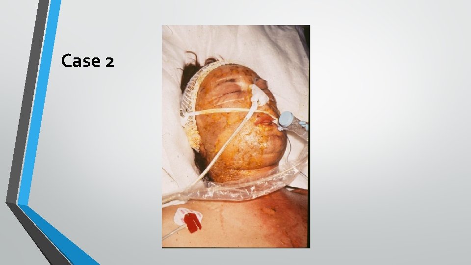 Case 2 