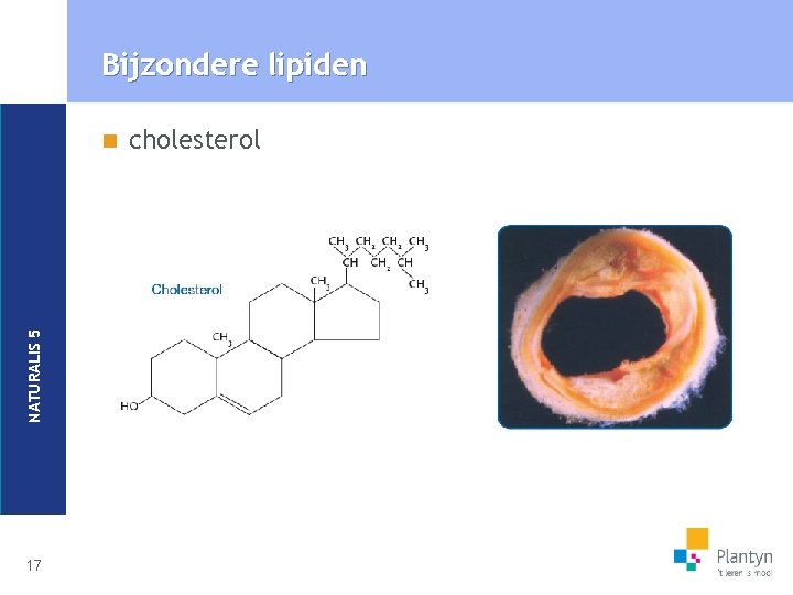 Bijzondere lipiden NATURALIS 5 n 17 cholesterol 