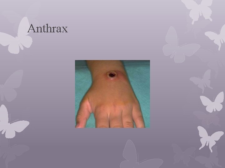 Anthrax 