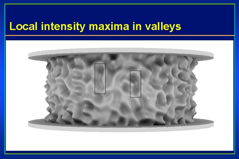 Local intensity maxima in valleys 