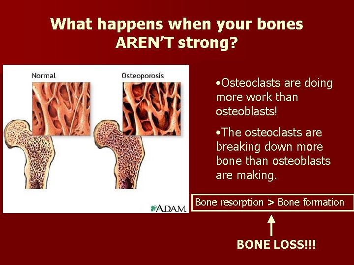 What happens when your bones AREN’T strong? • Osteoclasts are doing more work than