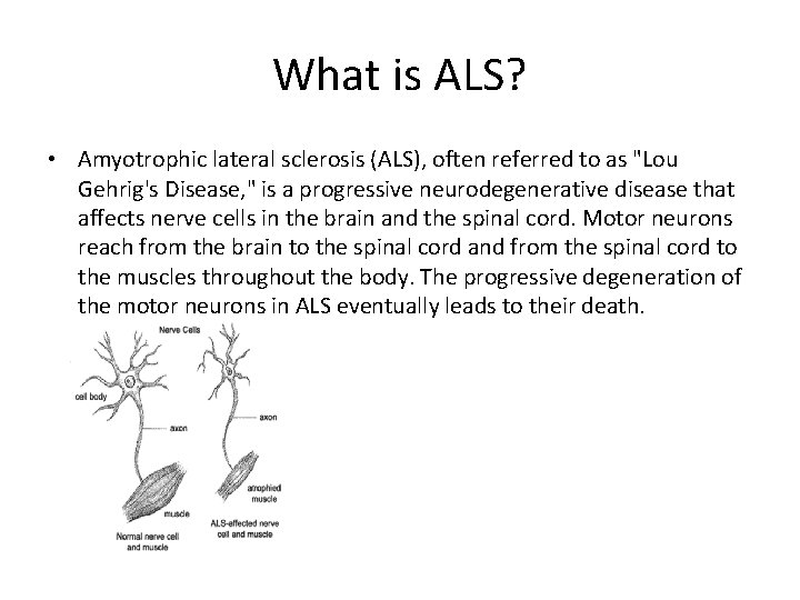 What is ALS? • Amyotrophic lateral sclerosis (ALS), often referred to as "Lou Gehrig's